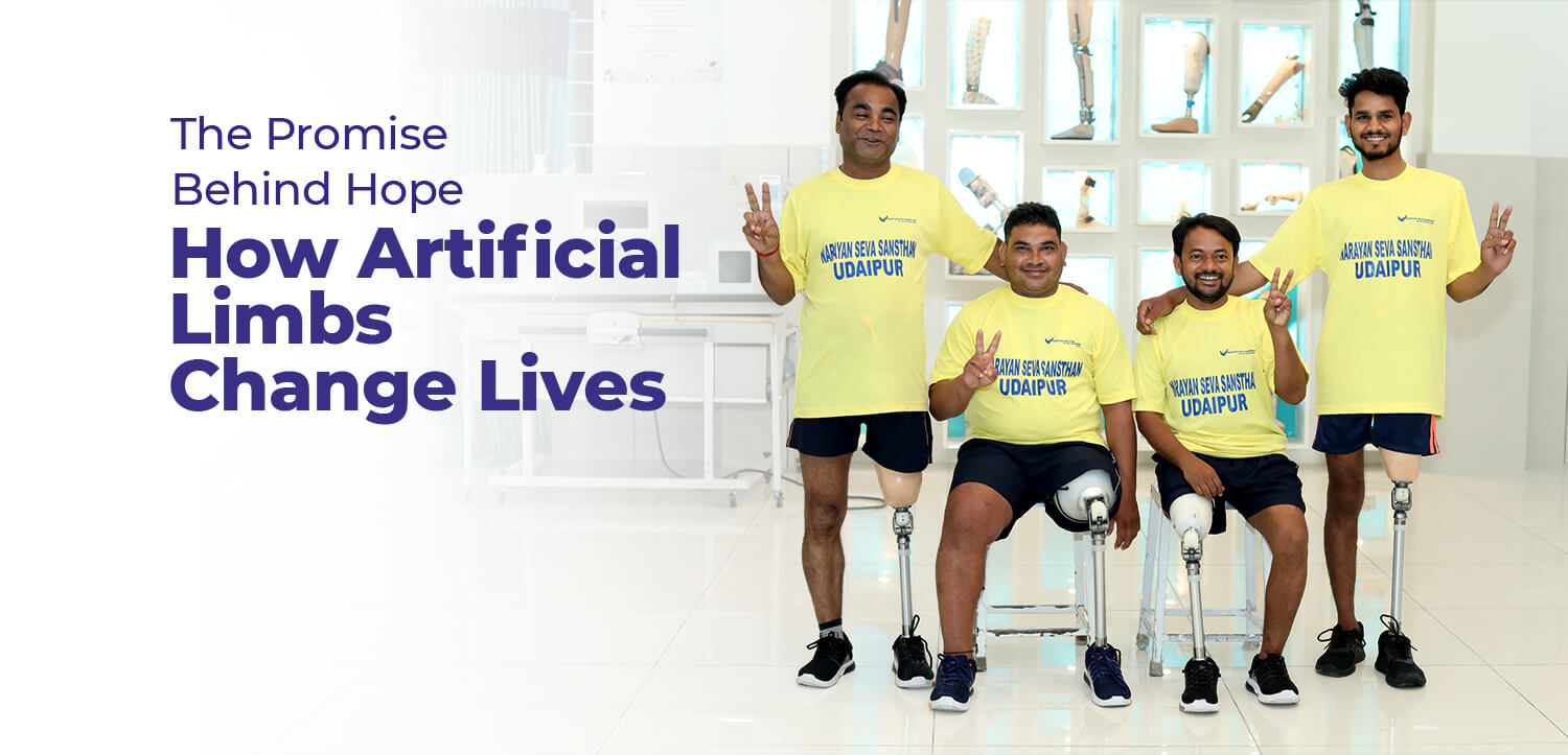 The Promise Behind Hope: How Artificial Limbs Change Lives