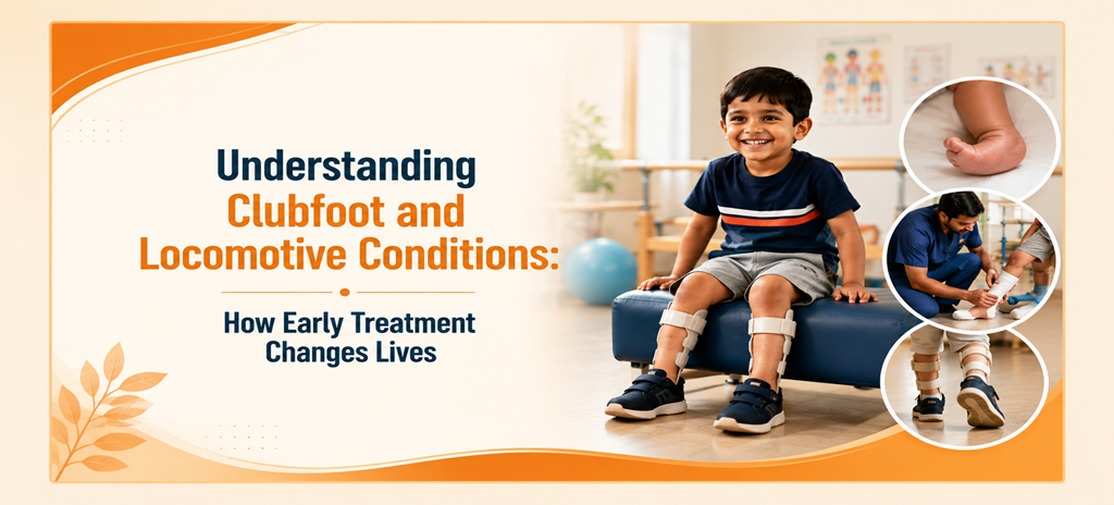 Understanding Clubfoot and Locomotive Conditions: How Early Treatment Changes Lives
